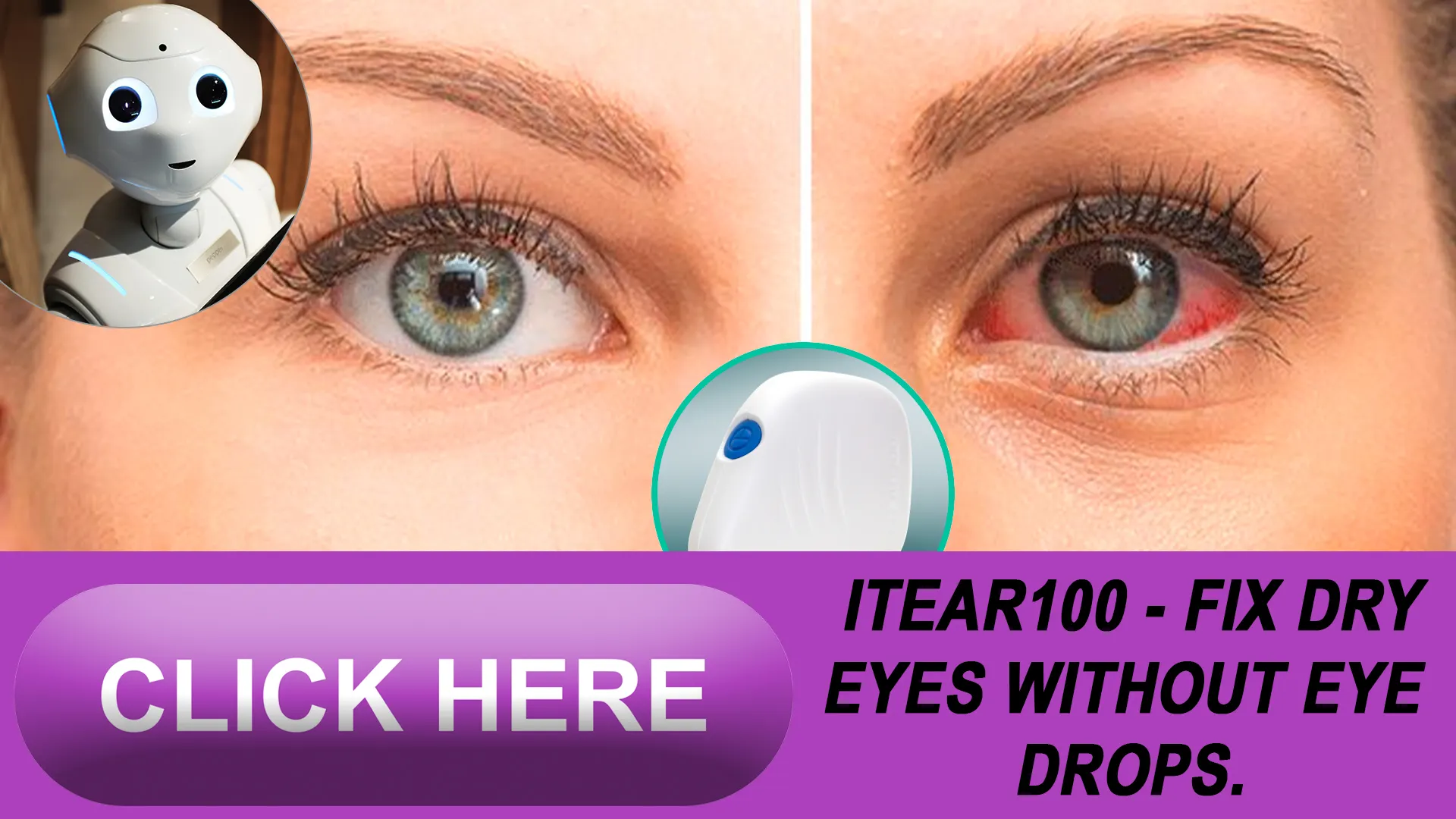 Addressing the Root Causes of Dry Eye